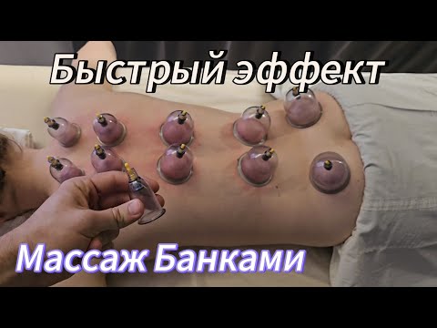 Видео: Баночный массаж/Вакуумный массаж спины