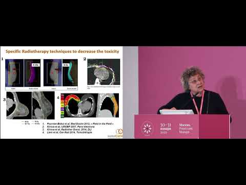 Видео: Целесообразность комбинированного применения лучевой терапии с PARP-ингибиторами и иммунотерапией