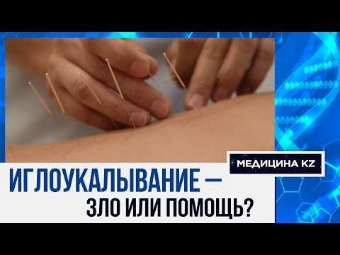Видео: Иглотерапия: как работает метод и в каких случаях помогает | Медицина KZ