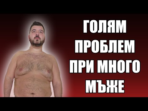Видео: Мъжки Гърди - Огромен ПРОБЛЕМ за много мъже