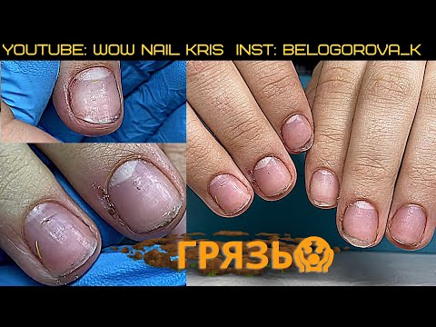Видео: Грязные руки, ногти это неуважение? Вы бы отказали?Наращивание| Рваные раны|Как обработать заусенцы