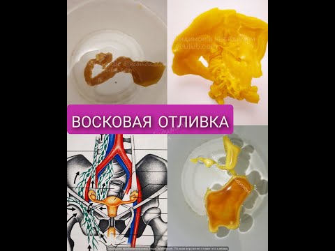 Видео: восковые отливки