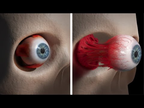 Видео: Що станеться з вами за 30 секунд у космосі без скафандра?