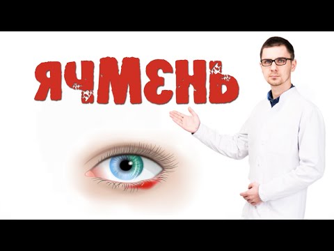 Видео: Ячмень на глазу причины и лечение