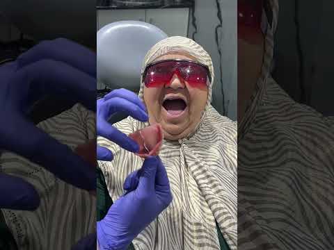 Видео: Функционал протез ( вакумли протез)