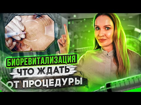 Видео: Что такое биоревитализация. Кому показана и как часто делать.