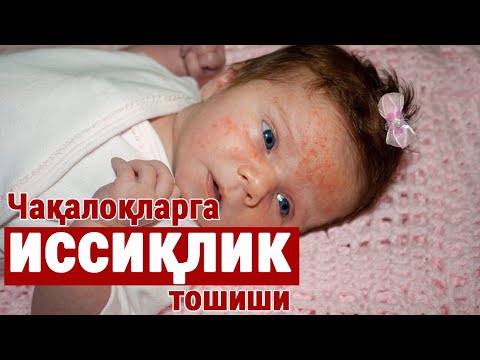 Видео: Чақалоқларга иссиқлик тошиши