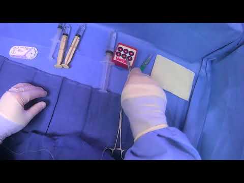 Видео: Закрепление линий (наложение швов вблизи места выхода)