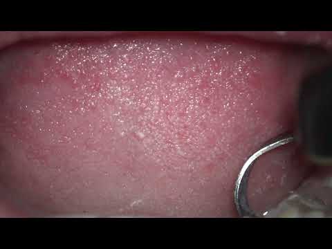 Видео: Клинический случай