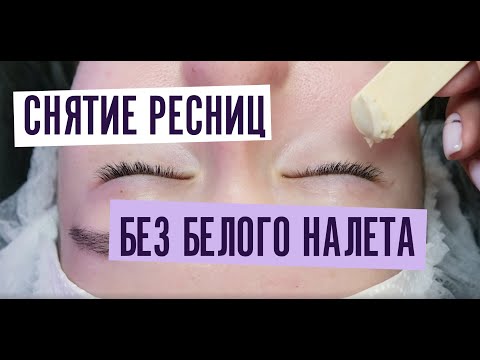 Видео: Как снять ресницы без белого налета? Снятие наращенных ресниц.