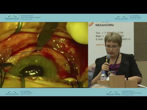 Видео: Современные возможности локального лечения увеальной меланомы. Взгляд офтальмоонкологов. Опыт СПб