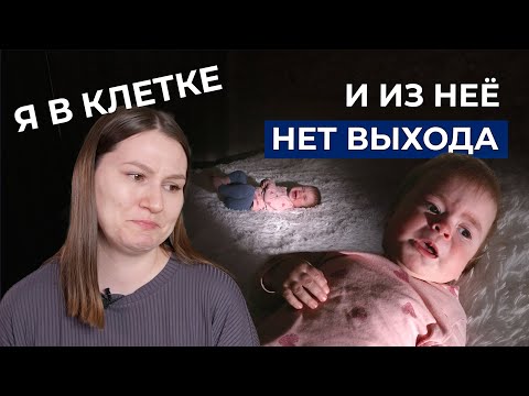 Видео: МУКОПОЛИСАХАРИДОЗ I ТИПА | История Есении Михайловой