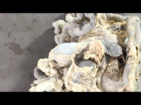 Видео: Тонкий и толстый кишечник, печень, поджелудочная железа