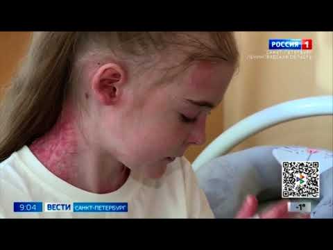 Видео: Лиза и Матвей Багровы, 13 и 6 лет, буллезный эпидермолиз
