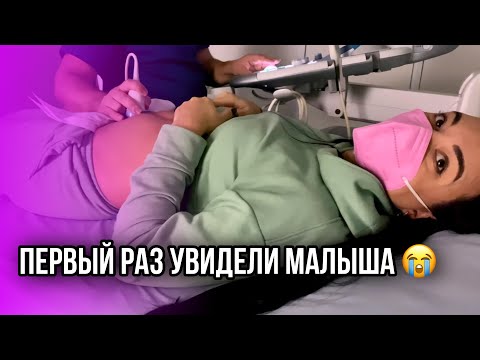 Видео: Скрининг Первый раз увидели ребенка. Но не получилось...