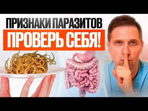 Видео: ГЛАВНЫЙ секрет борьбы с паразитами! 100% действенный метод!