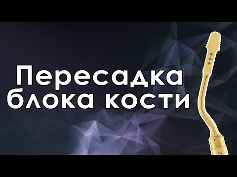 Видео: Забор костного блока от доктора Peter Moy