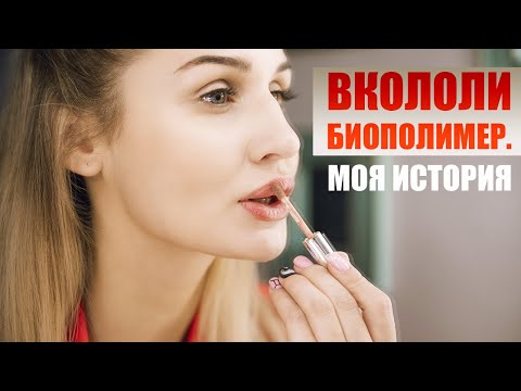 Видео: НЕУДАЧНАЯ ПЛАСТИКА ГУБ. ВКОЛОЛИ БИОПОЛИМЕР. ФИБРОЗ. МОЯ ИСТОРИЯ