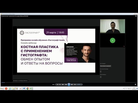 Видео: Костная пластика с применением Гистографта/Вебинар 29.03.2023