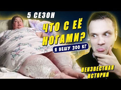 Видео: Я вешу 300 кг 5 сезон История Дианы Меган 🌺