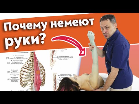 Видео: Что делать, если немеет рука? / 3 главных причины онемения рук