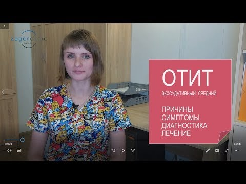 Видео: Экссудативный средний отит | Причины, симптомы, диагностика и лечение
