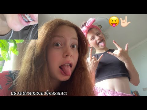 Видео: ставлю брекеты и мучаюсь 😩 VLOG