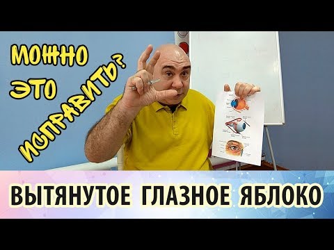 Видео: Исправление близорукости: как быть с вытянутым глазным яблоком