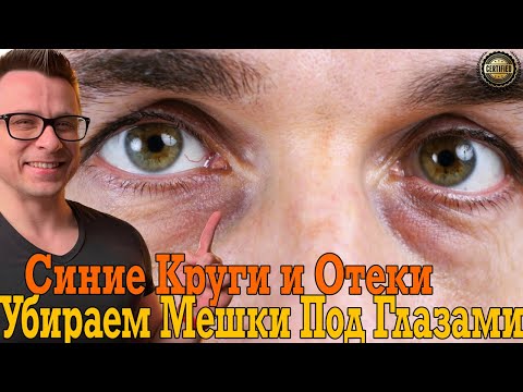 Видео: Убираем синие круги, мешки и отёки под глазами и на лице!