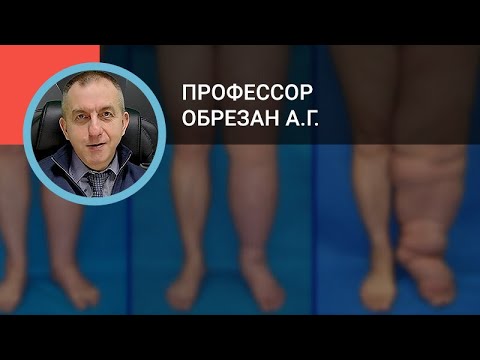 Видео: Профессор Обрезан А.Г.: Отёчный синдром