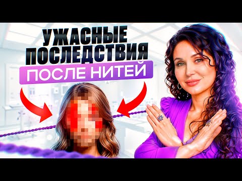 Видео: Делать нити или нет? Вся правда про нитевой лифтинг