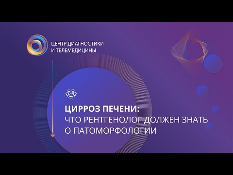 Видео: Цирроз печени: что рентгенолог должен знать о патоморфологии