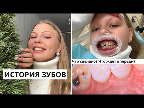 Видео: ИСТОРИЯ ЗУБОВ / и это не конец!🦷