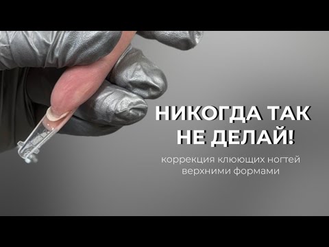 Видео: КАК НЕ НАДО делать коррекцию клюющих ногтей верхними формами ❌