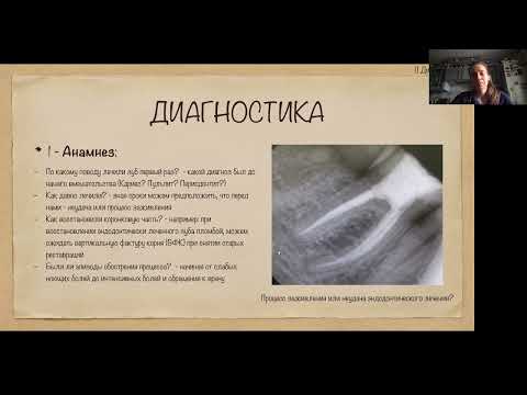 Видео: ЭНДОДОНТИЯ ДЛЯ НАЧИНАЮЩИХ ЧАСТЬ 1