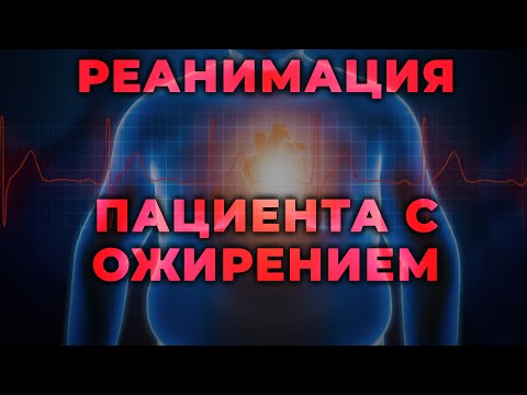 Видео: Реанимация пациента с ожирением. Особенности и хитрости. #ПроСМП