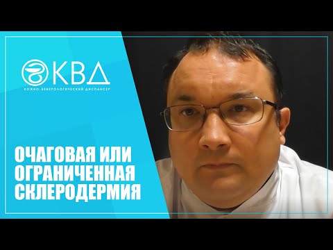 Видео: 1391  Очаговая или ограниченная склеродермия