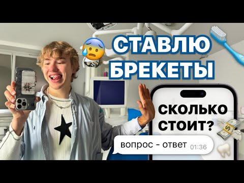 Видео: влог: ставлю брекеты + отвечаю на вопросы о них