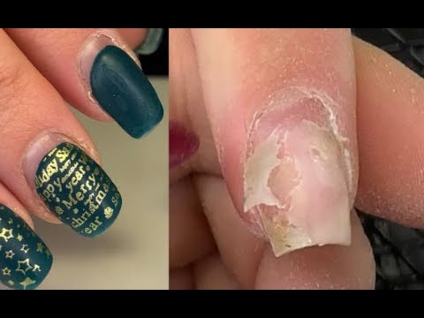 Видео: Жуткие отслойки😱Думала не исправлю😐Причины отслоек гель лака💅Преображение ногтей