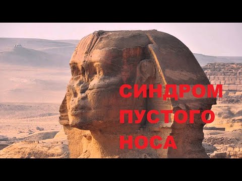 Видео: Синдром пустого носа. Садыхов Р.А.