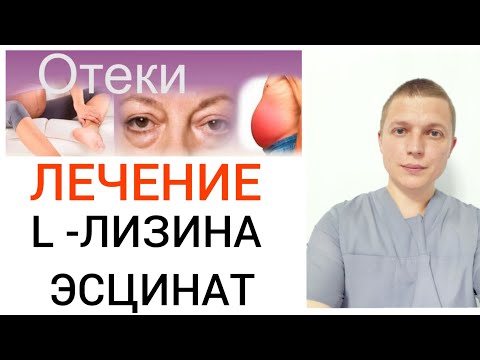 Видео: Лечение отёка l L- лизина эсцинат l Edema treatment