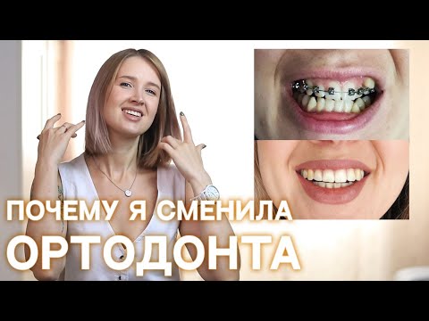 Видео: БРЕКЕТЫ ДО и ПОСЛЕ | Удаление восьмерок | Сколько стоит