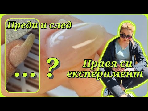 Видео: Експеримент 🙄 Счупен нокът, поправка с три различни бази 💚#kodi