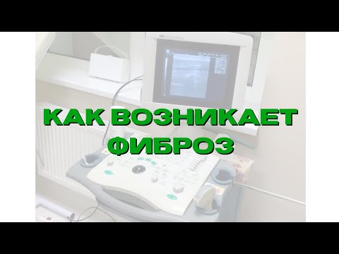 Видео: Почему Боль в спине НЕ проходит или Как  возникает МИОФИБРОЗ?
