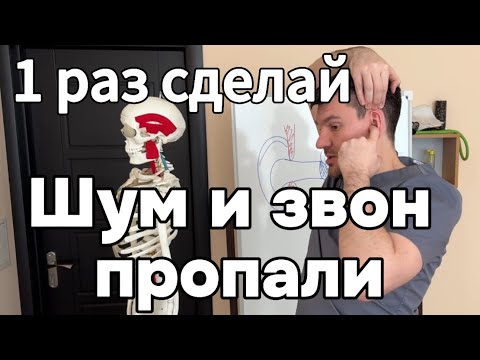 Видео: Шум и звон в ушах прошел и будешь лучше слышать уже после 1 раза если сделаешь