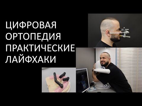 Видео: ЦИФРОВАЯ ОРТОПЕДИЯ ЧЕМ Я РАБОТАЮ
