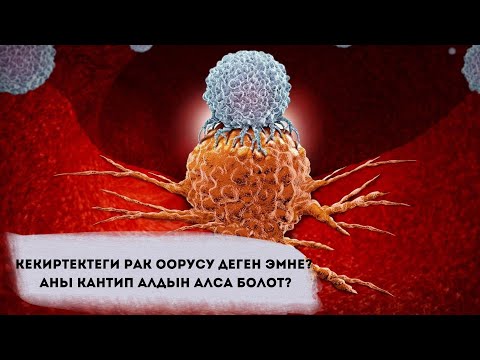 Видео: Кекиртектеги рак оорусу деген эмне? Аны кантип алдын алса болот? #Ынтымак