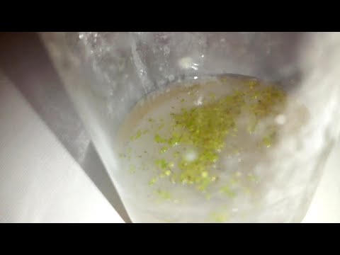 Видео: Результат посева семян орхидеи через 1,5 месяца