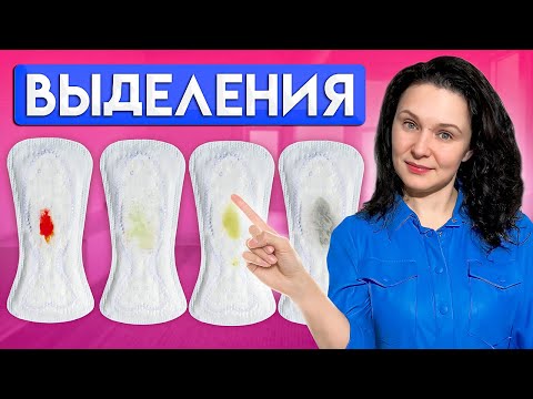 Видео: Выделения из влагалища. Такие выделения НЕ НОРМА!