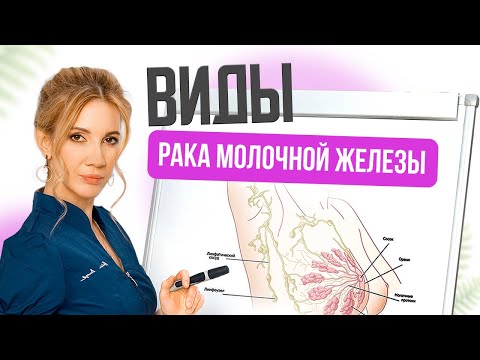 Видео: Виды рака молочной железы. Сравнение и главные отличия простыми словами